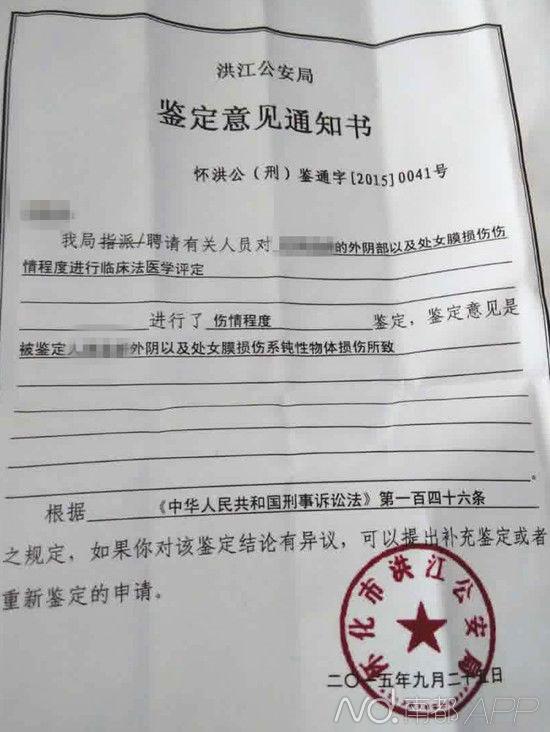 湖南怀化4岁女童疑遭性侵 司法鉴定下体有伤