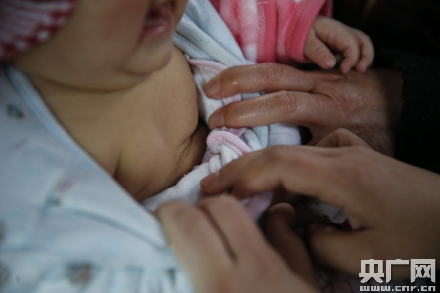 五个月女婴乳房发育 专家称不一定与奶粉有关